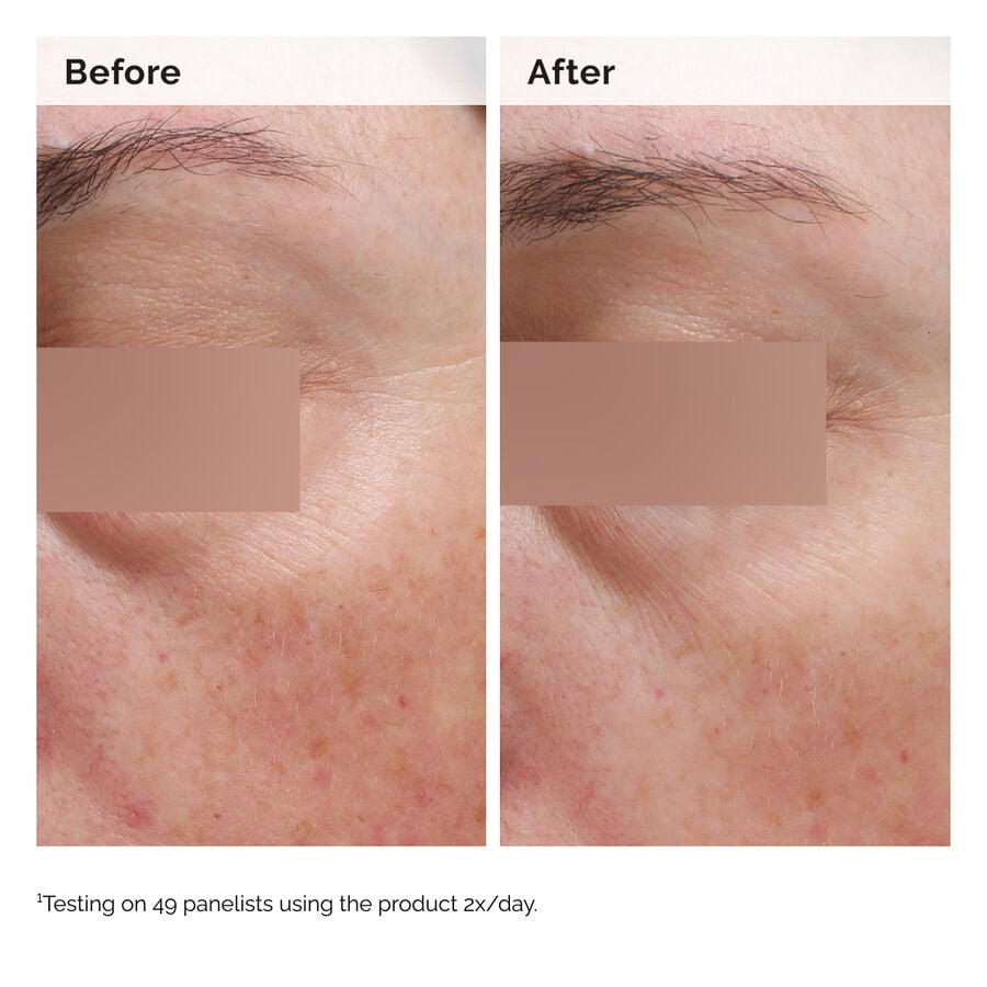 niacinamide-5-face-and-body-emulsion-a4 2024-08-23-ORD-Nia-5pct-Face-Body-B-A-Elasticity-Global-02-1x1.jpg