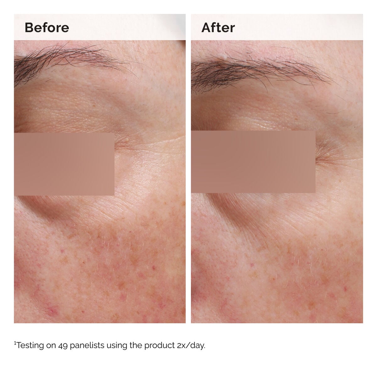 niacinamide-5-face-and-body-emulsion-a4 2024-08-23-ORD-Nia-5pct-Face-Body-B-A-Elasticity-Global-02-1x1.jpg