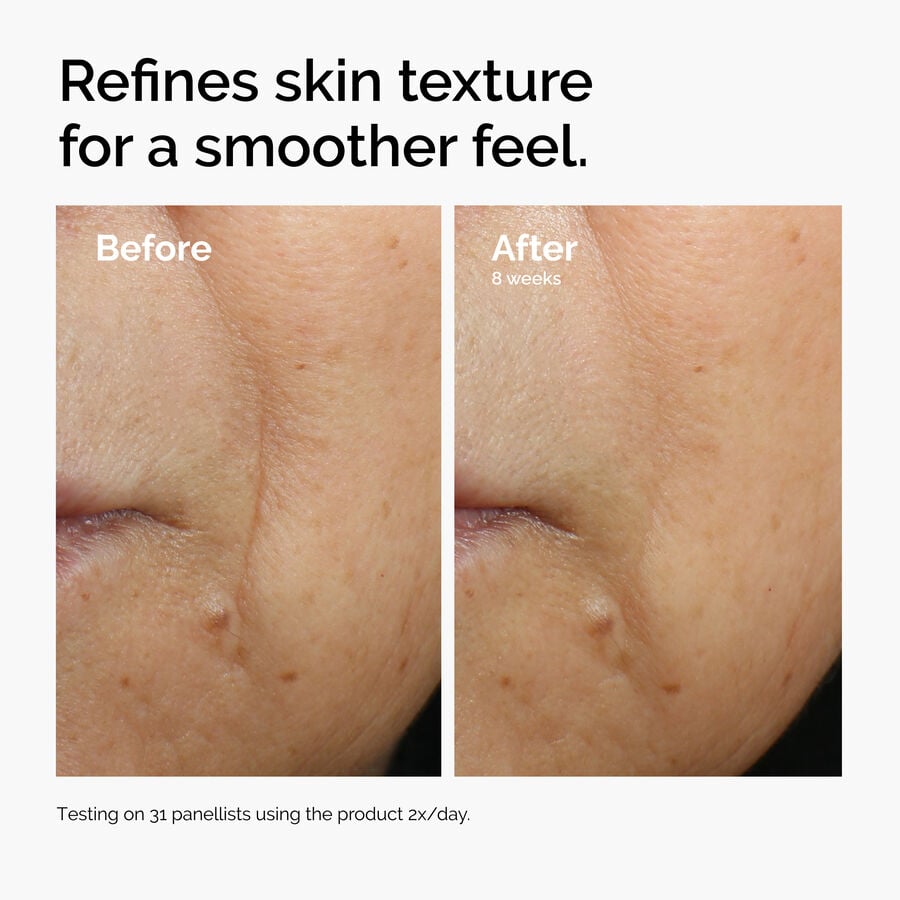 caffeine-3-escin-1-face-serum-m9 ord-caffeine-3pct-escin-1pct-face-serum-before-after-texture.jpg