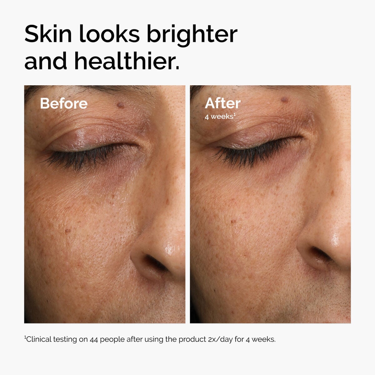 multi-antioxidant-radiance-serum-q1 ord-mars-before-after-healthy.jpg