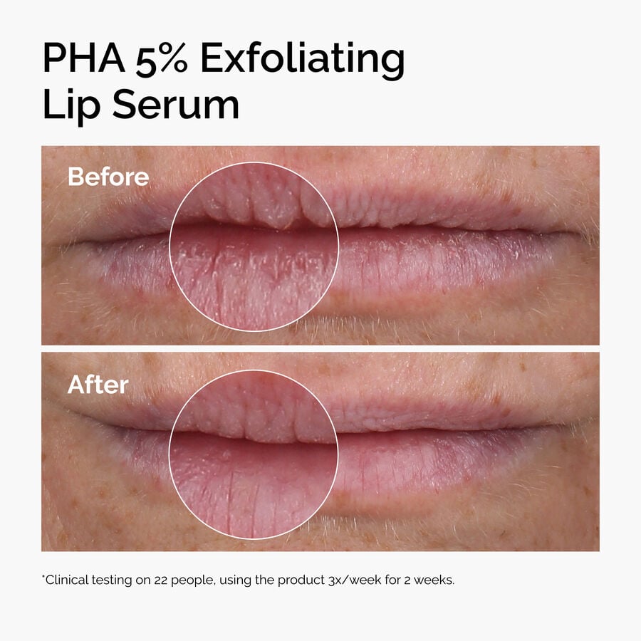 pha-5-exfoliating-lip-serum-t6 ord-pha-5pct-lip-exfoliating-serum-before-after.jpg